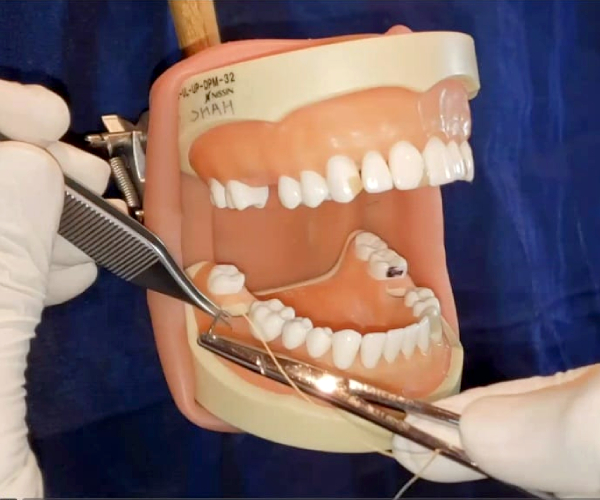 ORAL SURGERY FOR GENERAL DENTIST