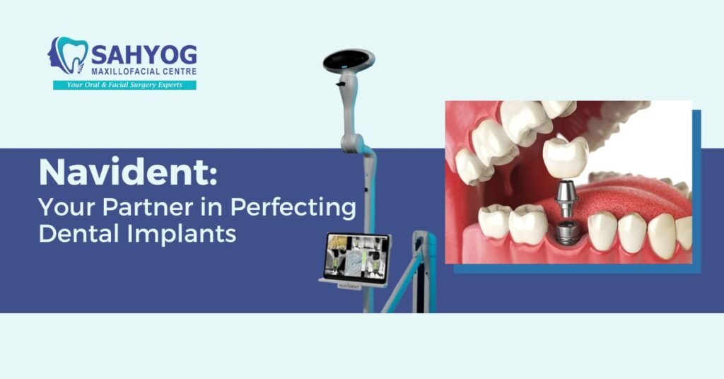 Navident - Your Partner In Perfecting Dental Implants